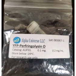 YFP-Perfringolysin O