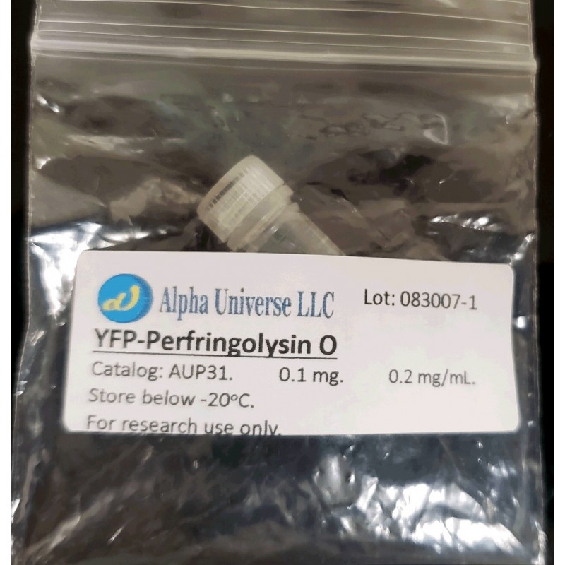 YFP-Perfringolysin O